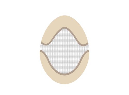 M15: Lace Hair System with PU Perimeter